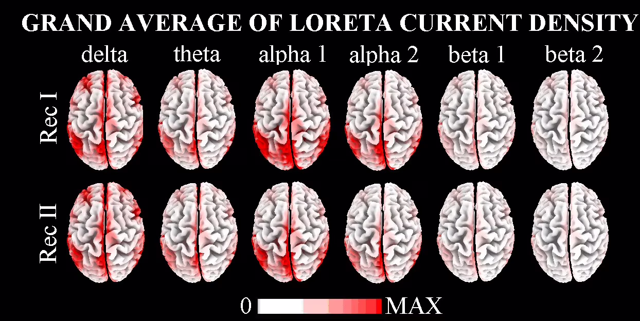 Grand average of LORETA current density