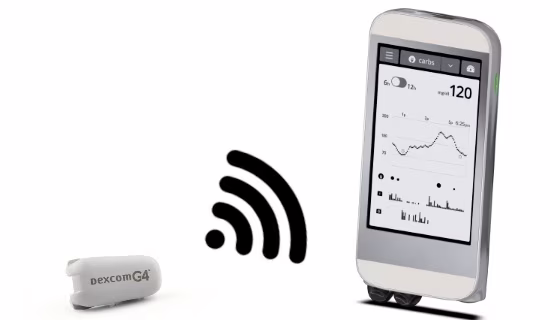 Bionic pancreas with a smartphone