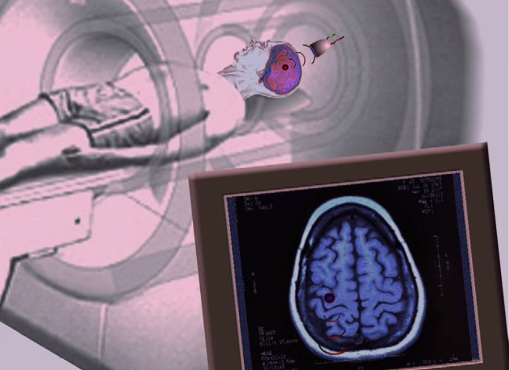 LIUFP utilizzata simultaneamente alla rtfMRI imaging.