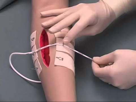 Applicazione delle Top Closure 