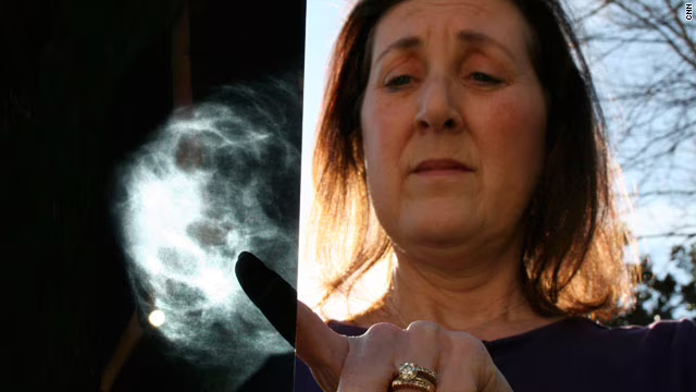 mammografie intelligenza artificiale natural language processing lotta al cancro Sara fought