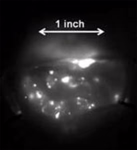 esempio di cellule tumorali illuminate dal mezzo di contrasto