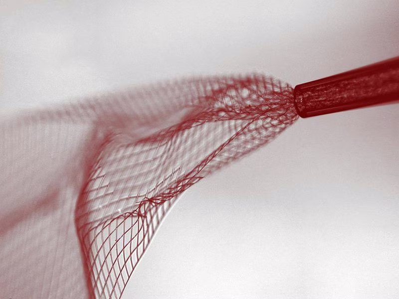 Neural Lace