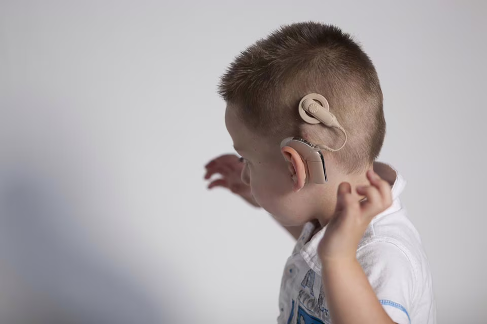 Un bambino con impianto cocleare