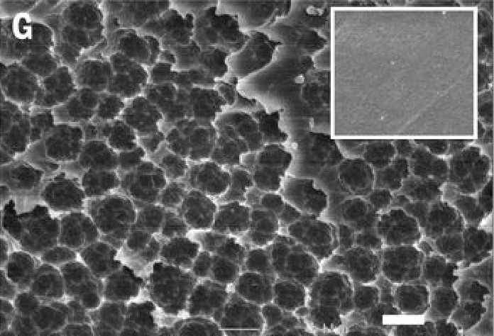 Il batterio che mangia la plastica