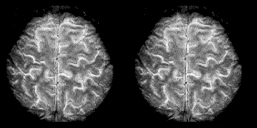 High resolution FMRI of the Human Brain.