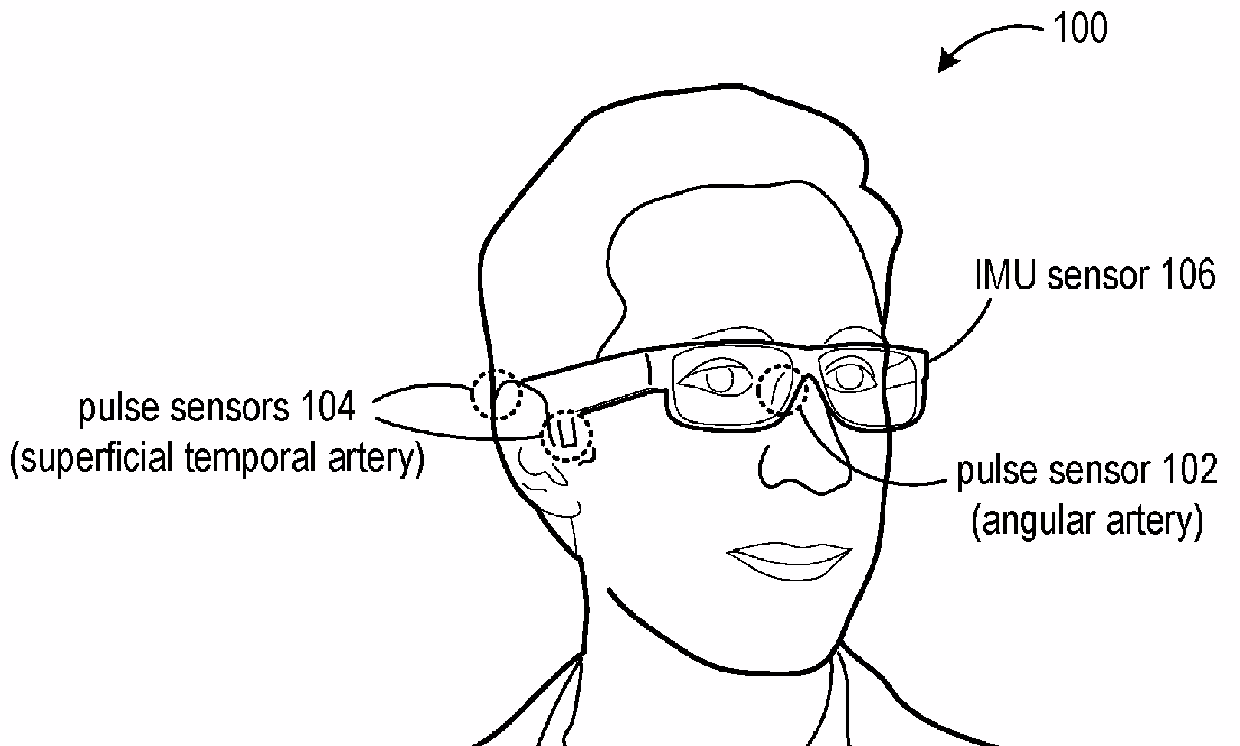 Glabella