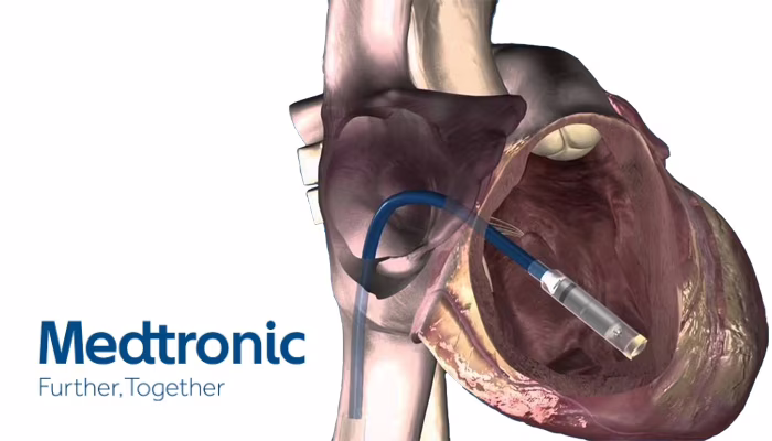 Micra TPS: il pacemaker senza fili più piccolo al mondo