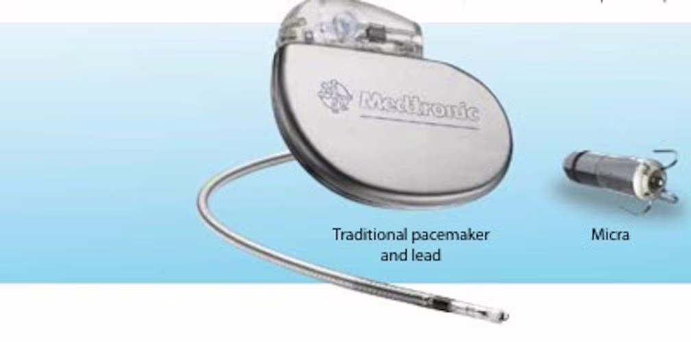 Micra TPS: il pacemaker senza fili più piccolo al mondo