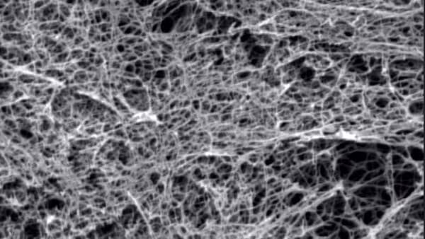 Neuroprotesi: creato in Italia il primo tessuto nervoso umano in laboratorio