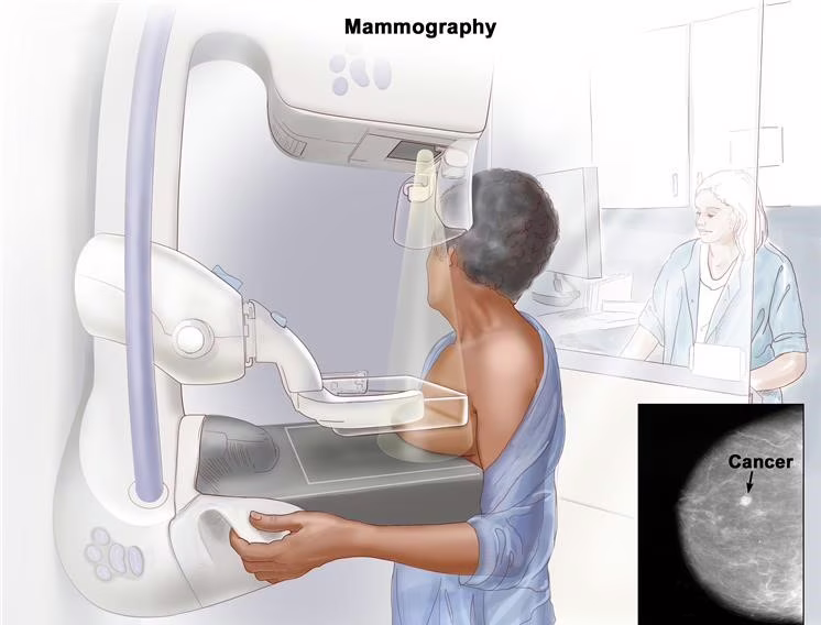 tumore seno mammografo mammografia prevenzione ottobre