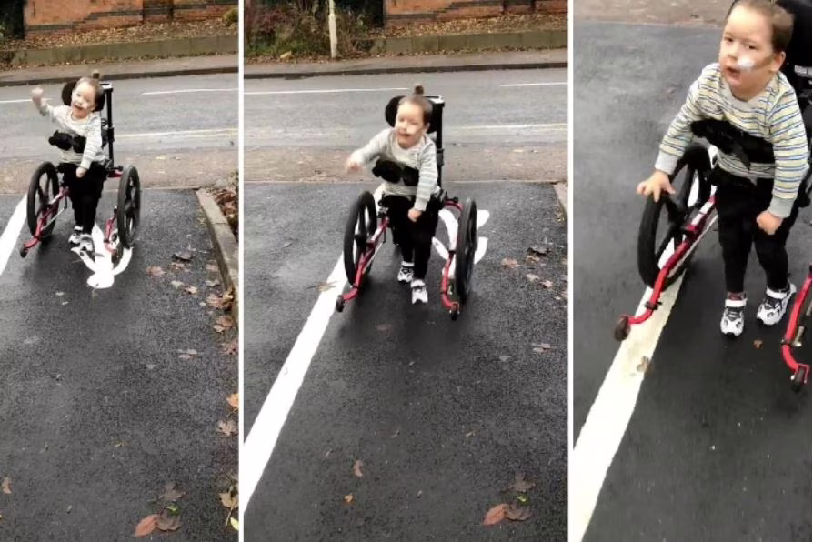 bambino compie primi passi rizotomia dorsale selettiva paralisi cerebrale