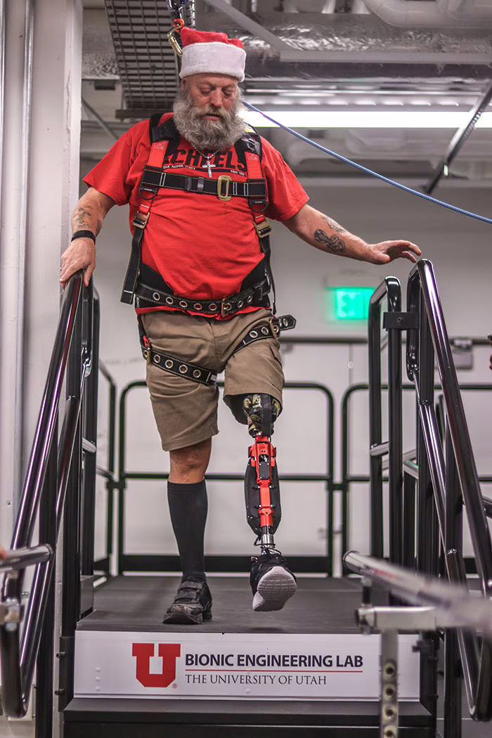 Kerry Finn protesi gamba progetto Bionic Leg utah