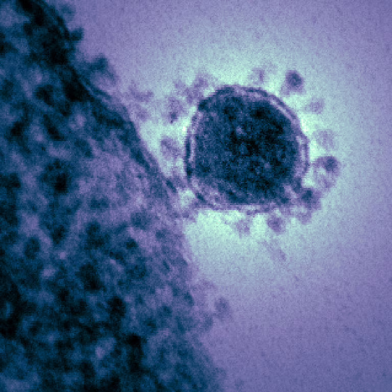 vaccino contro coronavirus