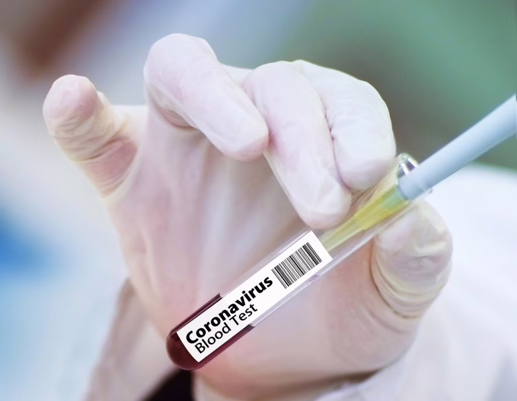 plasma terapia coronavirus