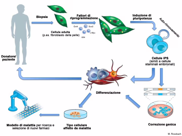 Scoperto il gene ZNF398 
