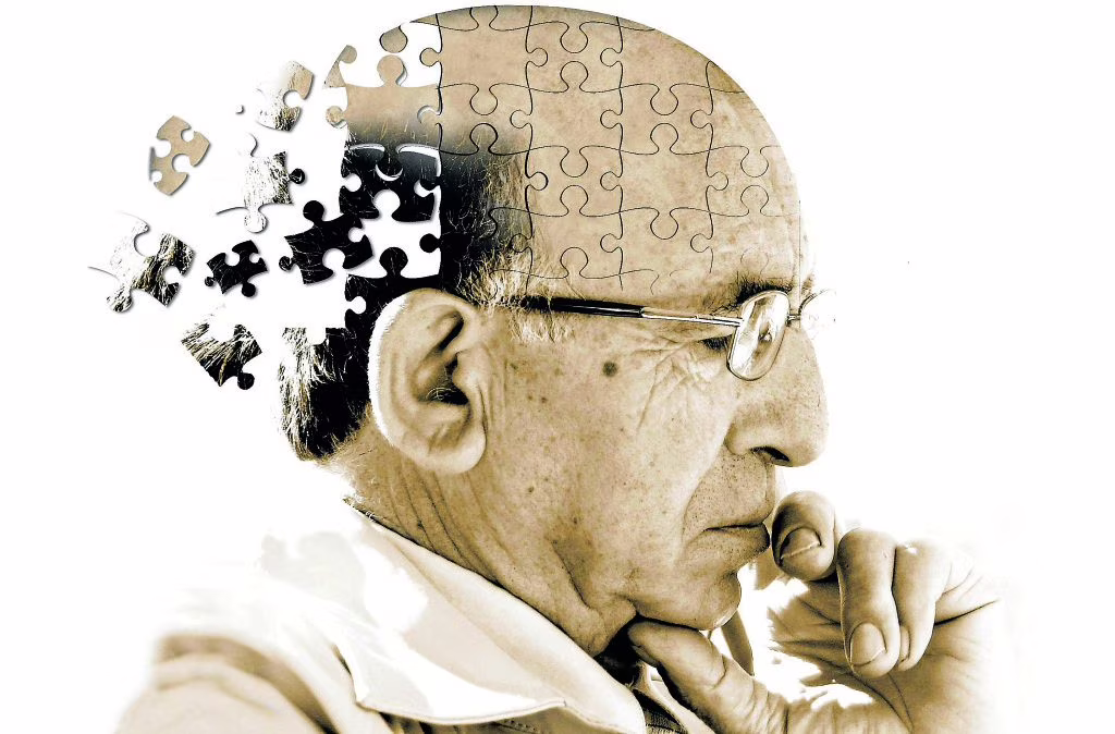 Alzheimer: identificati nuovi geni che innescano la malattia