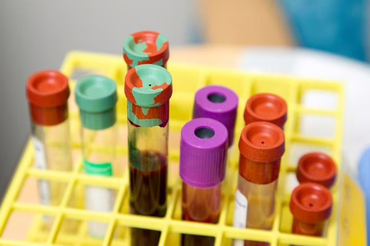 Cura spontanea hiv. Dubbi e domande