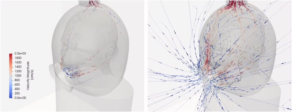 casco covid dentisti prototipo dpi protezione credits: physics of fluids