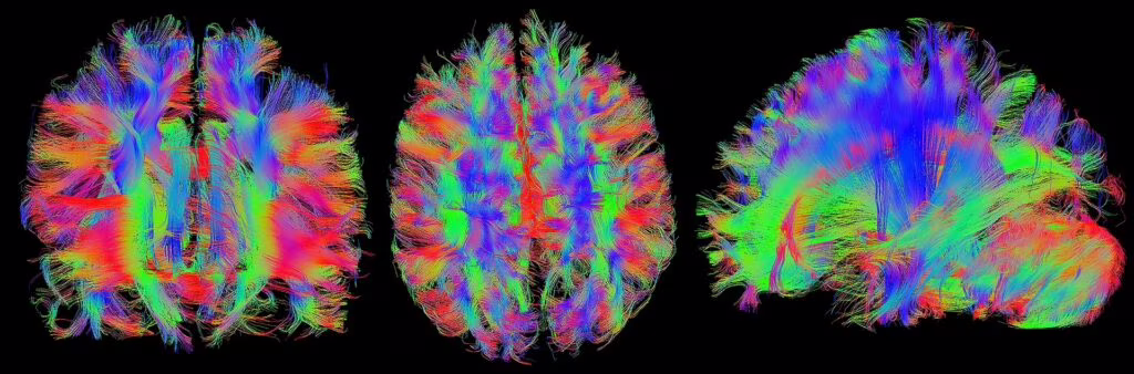 Risonanza magnetica con DTI: l’importante strumento per il neuroimaging. Credits: humanconnectomeproject.org