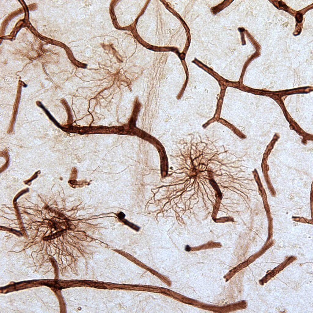 Le differenze nelle cellule cerebrali delle persone con depressione. Credits: Liam O'Leary