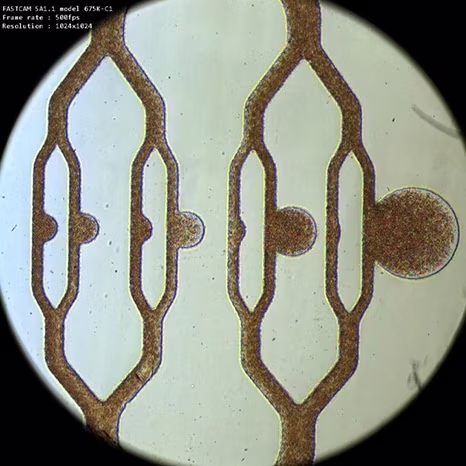 aneurisma su chip