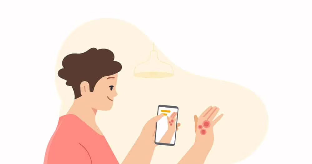 AI di Google per le malattie della pelle