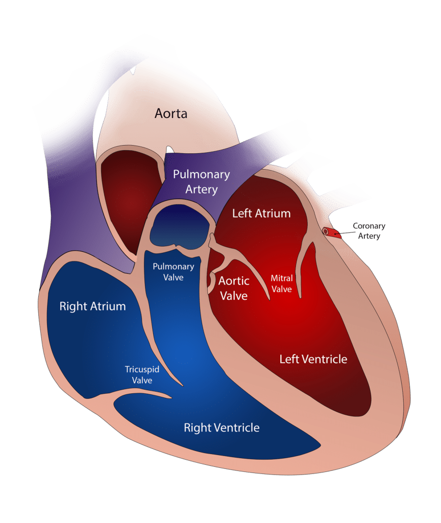 pacemaker cardiaco temporaneo