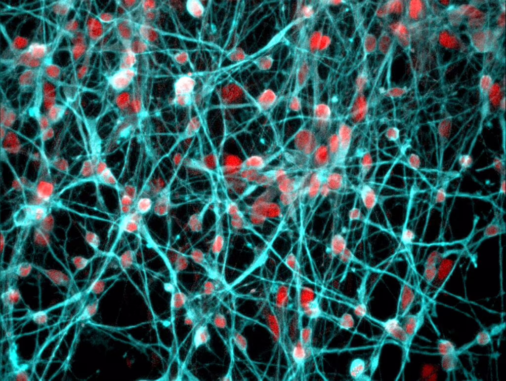 Identificati i bersagli genetici degli ormoni coinvolti nello stress cronico. Credits: University of Bristol