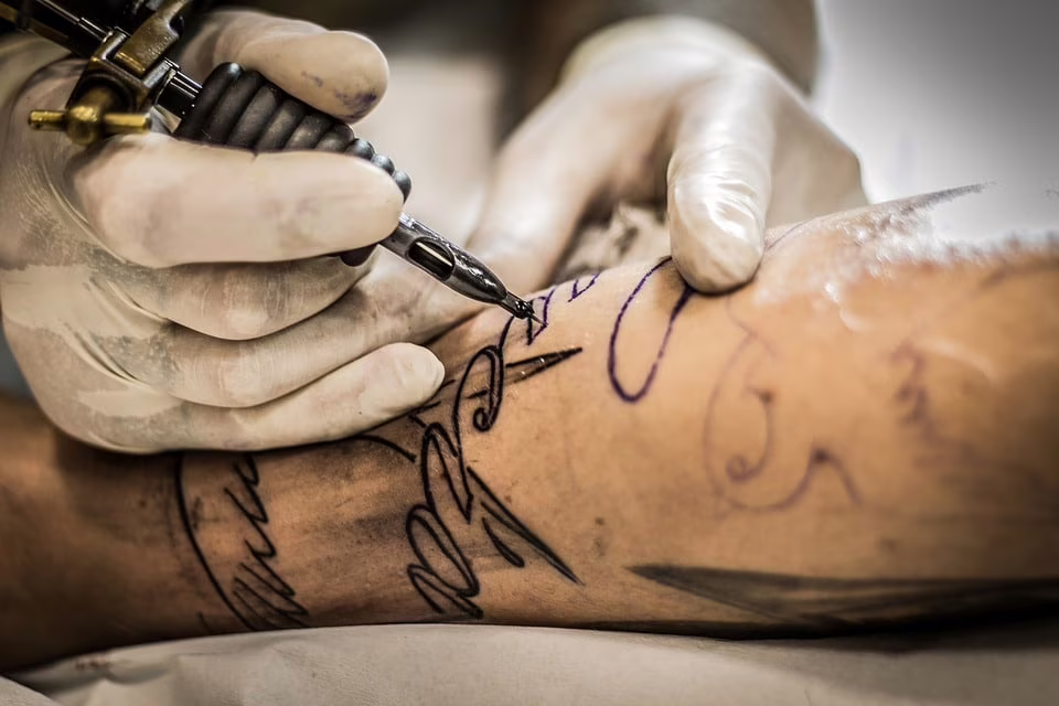 rimuovere un tatuaggio
