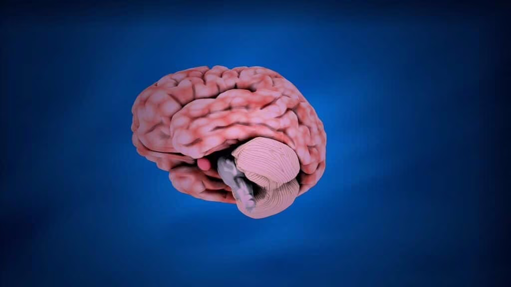 Nuovi risultati nel trattamento della depressione tramite stimolazione cerebrale profonda