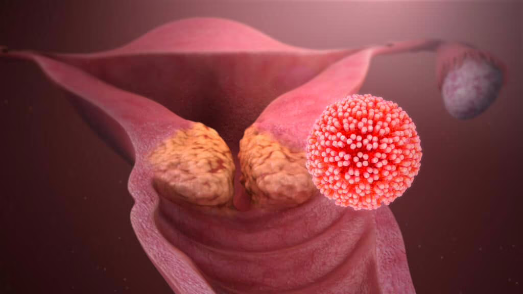 Infezioni da Papilloma Virus (HPV): tra le più trasmesse per via sessuale
