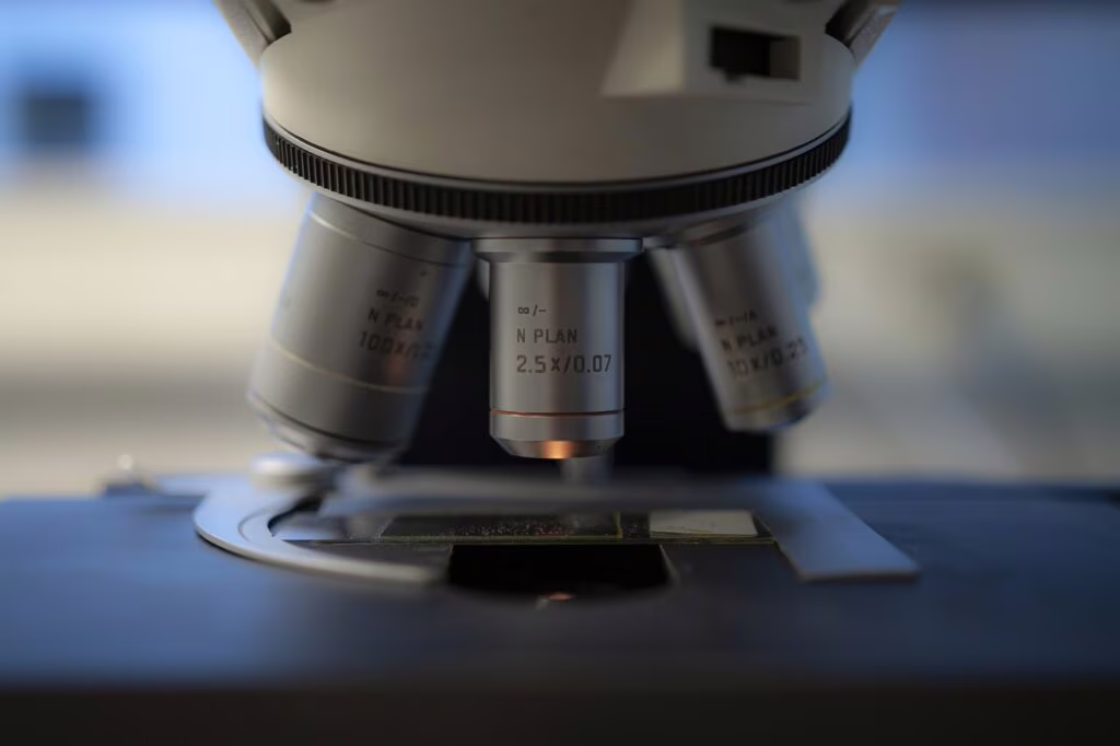 Dieci anni senza leucemia: la terapia CAR-T salva due pazienti