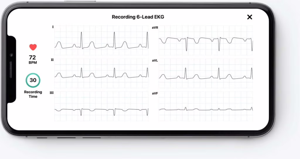 ECG personale, portatile e durevole, il più sottile mai creato: KardiaMobile Card