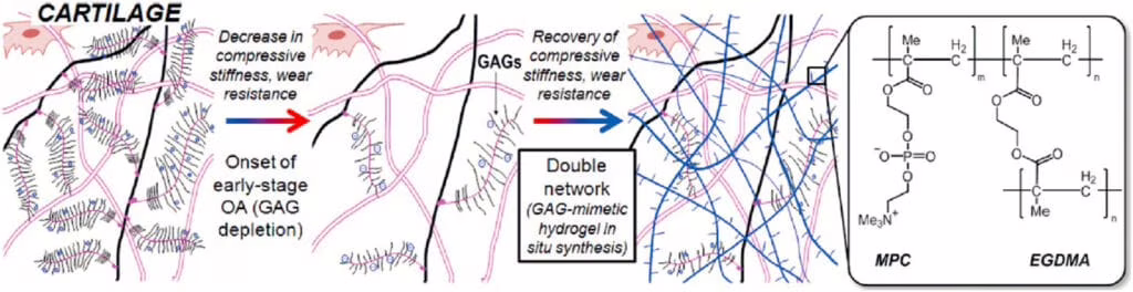 Osteoartrite hydrogel cartilagine