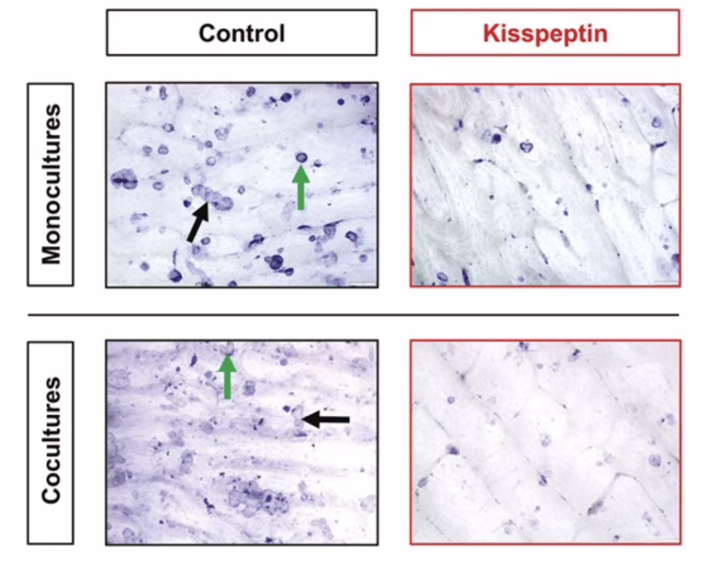 osteoporosi e kisspeptina