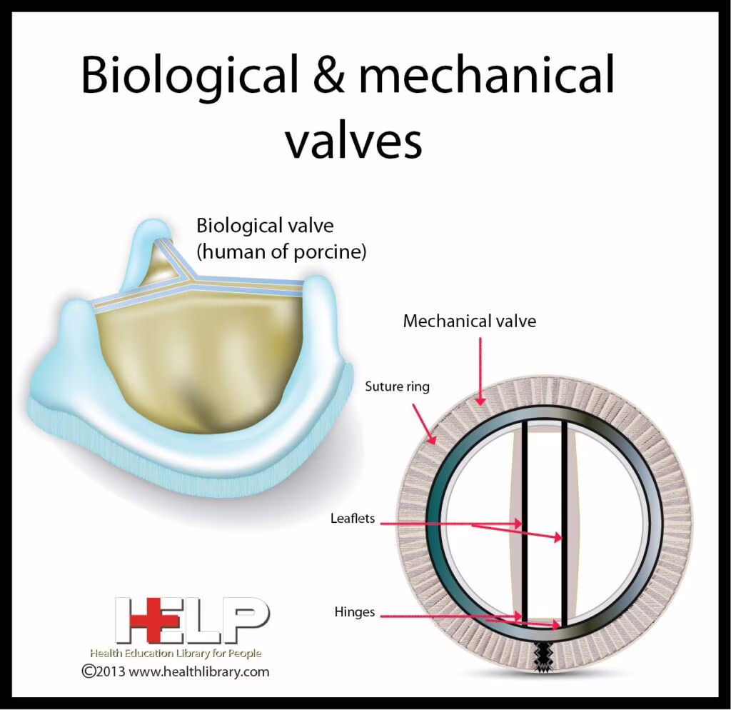 Valvole cardiache: in via di sviluppo un’innovativa protesi tissutale