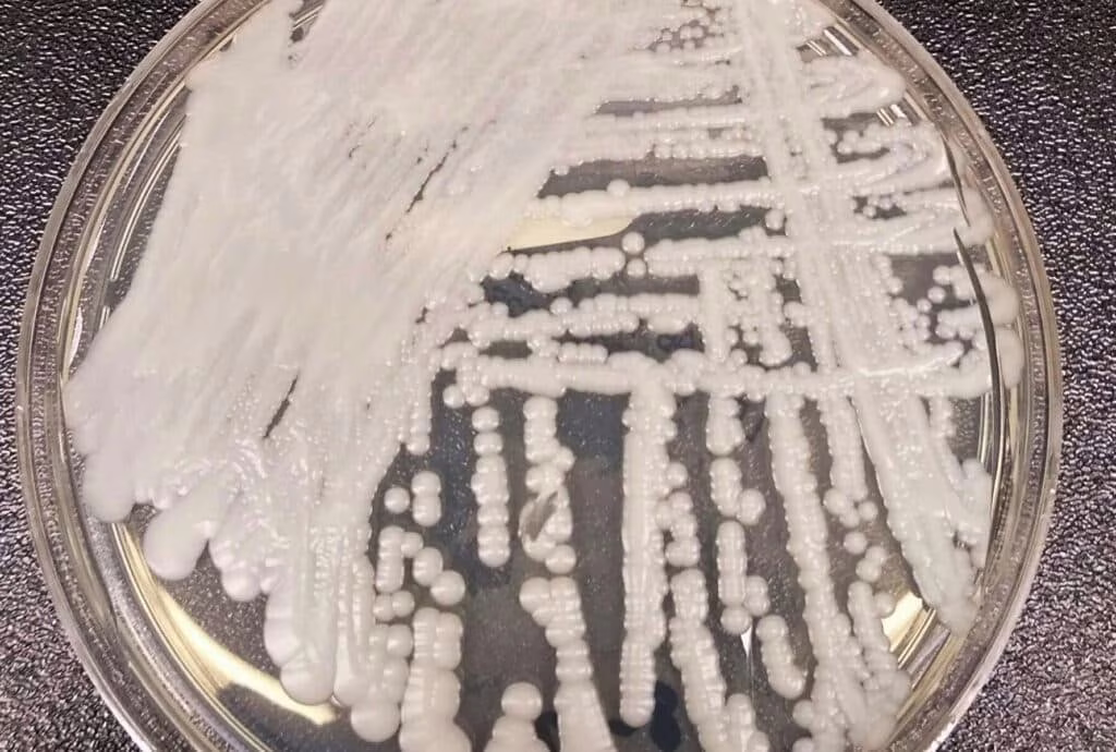 Candida Auris