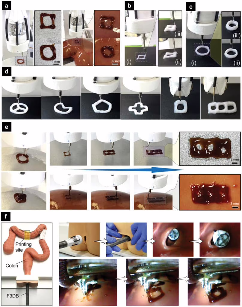 robot colon