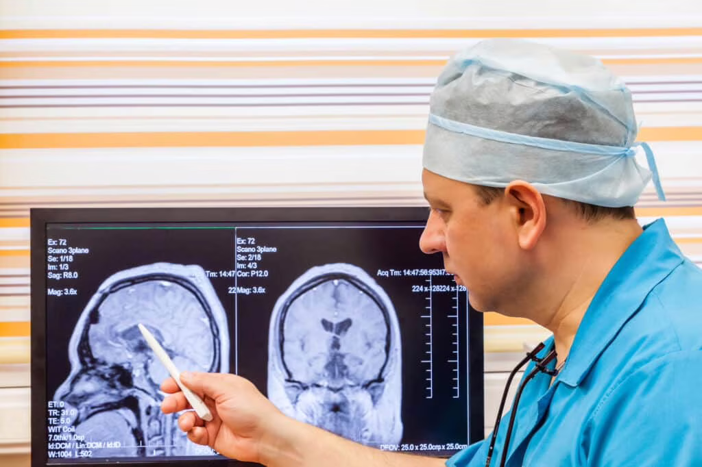 cervello mri