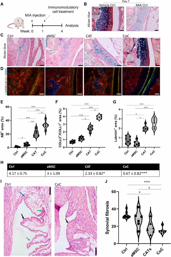 Osteoartrite 