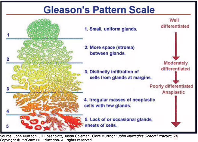 Gleason