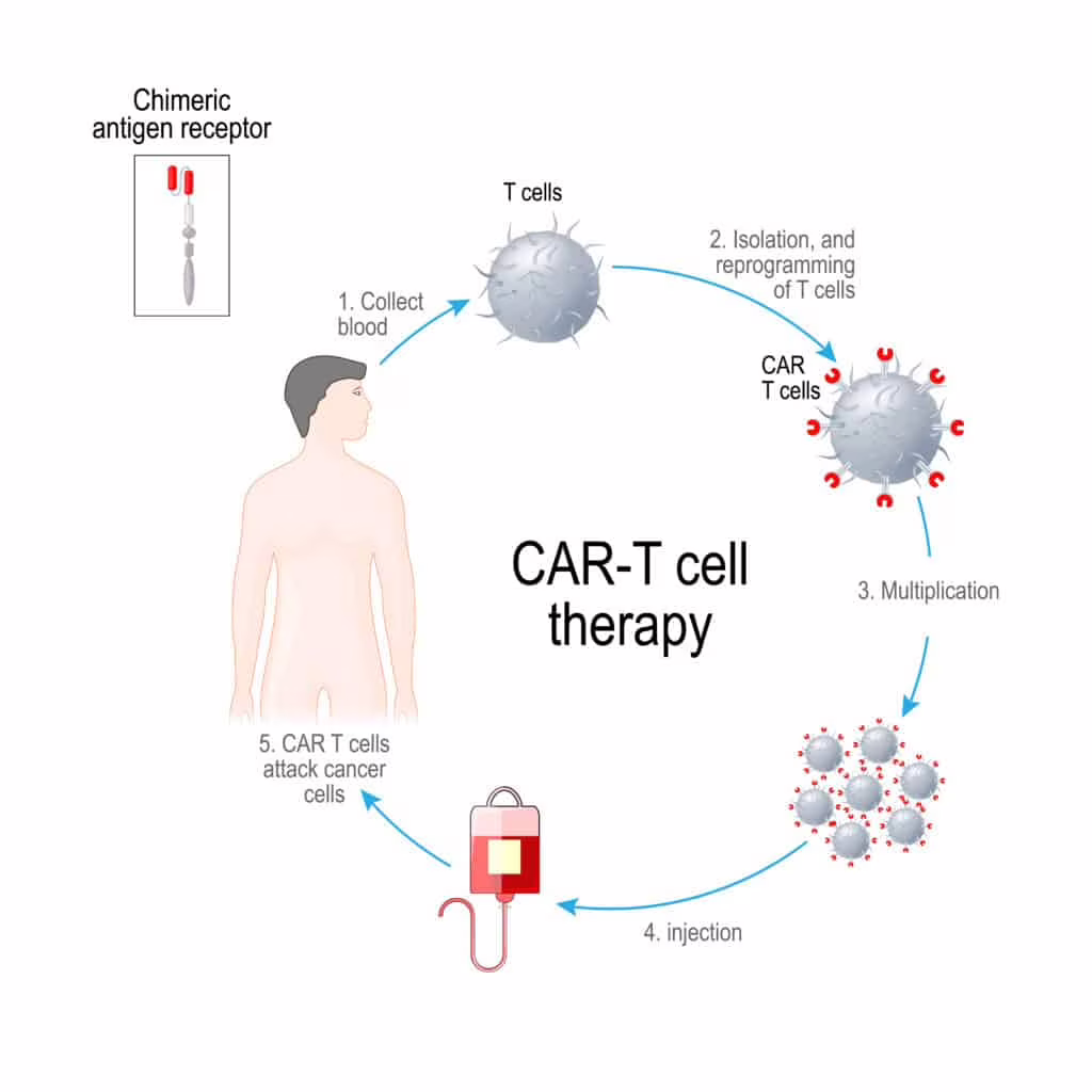 CAR-T