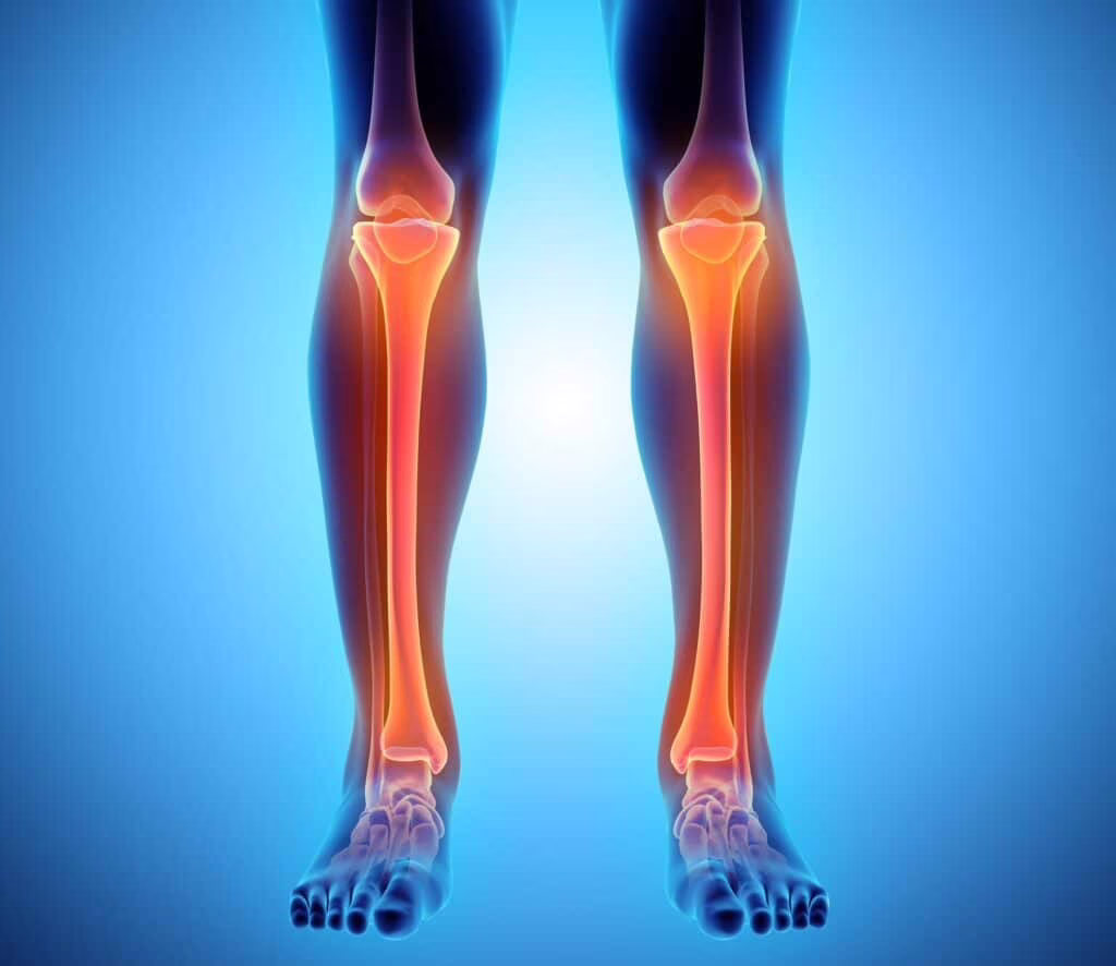 La tibia e il perone sono fondamentali per il supporto del peso e la mobilità della gamba, e la loro frattura, derivanti da traumi diretti o indiretti, richiedono cure specializzate e riabilitazione per garantire una corretta guarigione e il ripristino delle funzioni.
