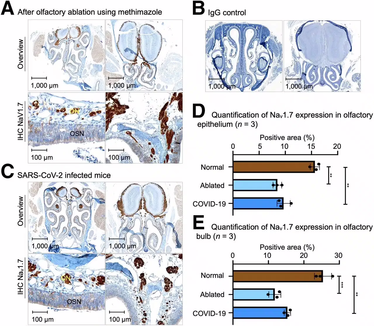 anosmia bulbo olfatto