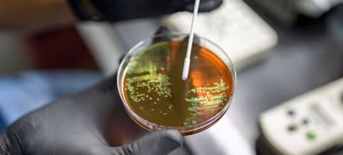OMS atualiza lista de bactérias que mais ameaçam a saúde humana - Jornal O São Paulo