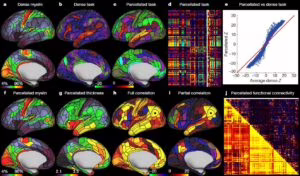Una nuova mappa del cervello umano