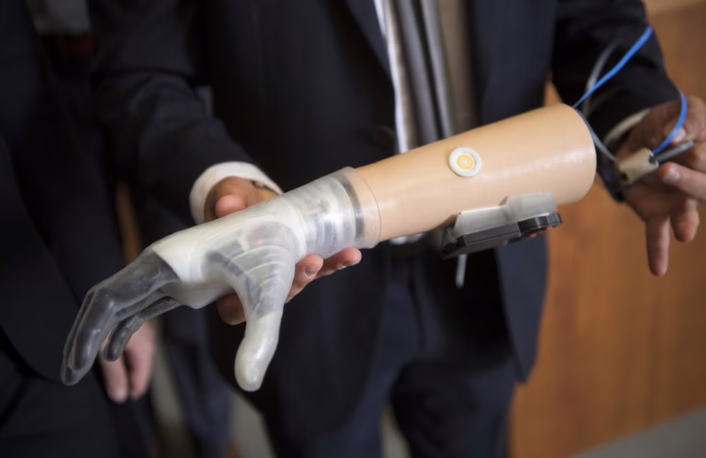 Hannes: la nuova mano bionica di INAIL e IIT