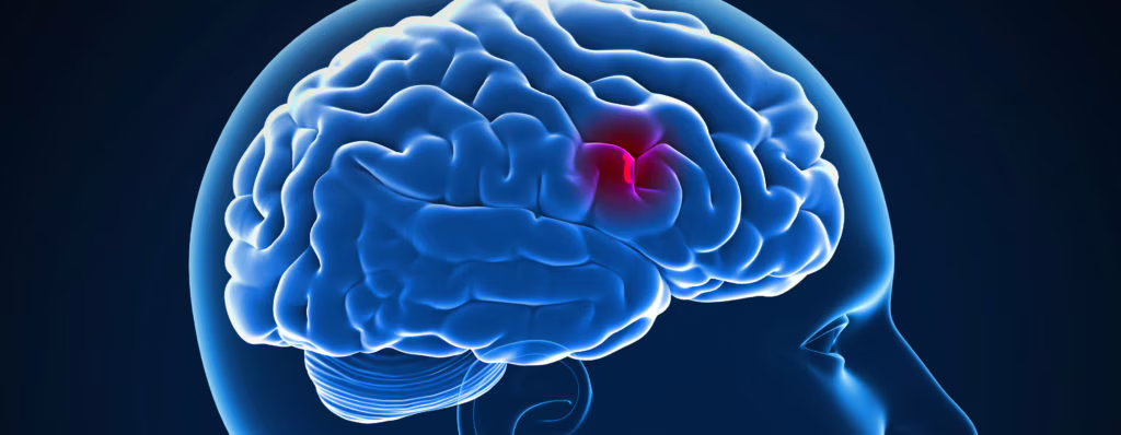 Un gel per riparare i tessuti colpiti da ictus