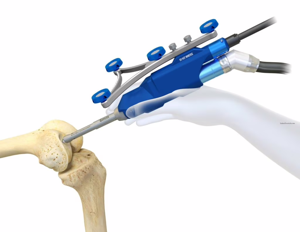 Napoli: primo intervento di chirurgia robotica ortopedica in Campania